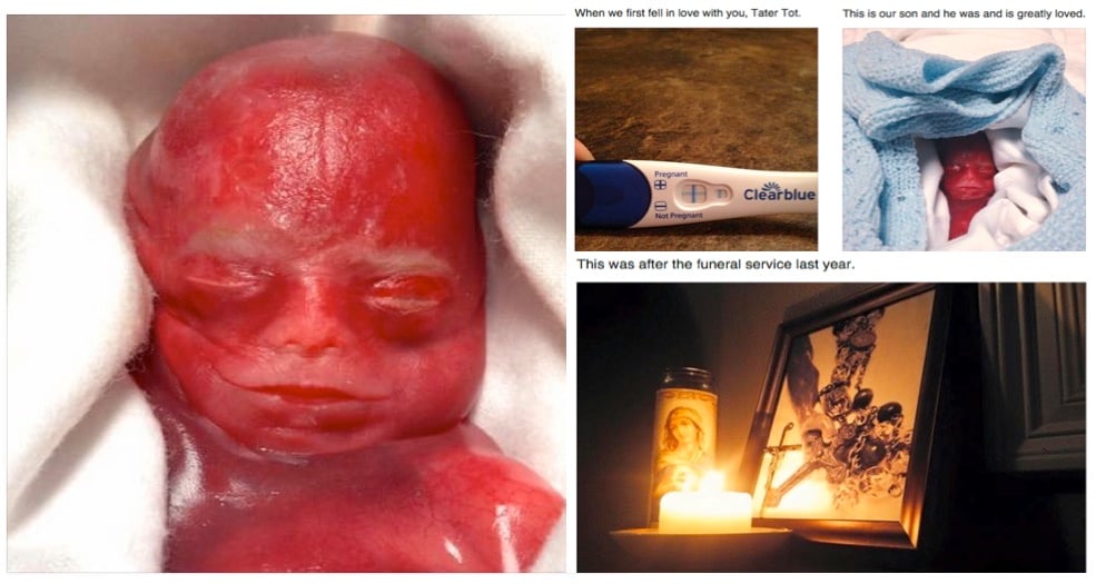 mj-godupdates-mom-refuses-to-take-down-stillborn-photos-5