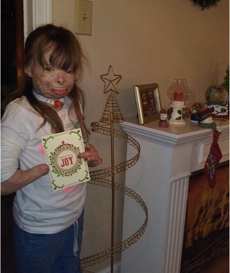 mj-godupdates-burned-orphan-wishes-for-christmas-cards-4