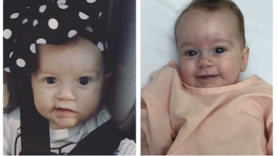 Their Baby's Brain Tumor Baffled Doctors After God Sent A Miracle