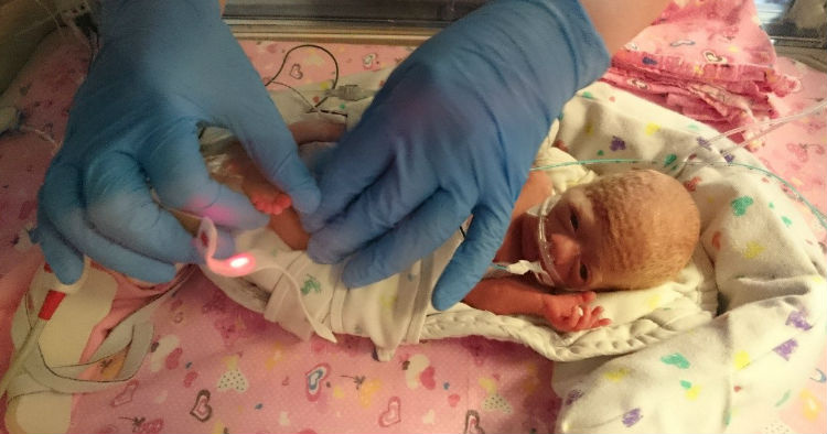 miracle baby pixie kept alive in plastic bag