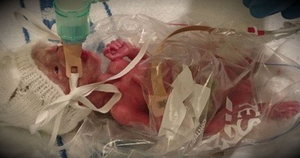 godupdates-baby-pixie-kept-alive-in-plastic-bag-fb
