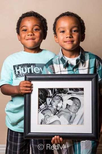 Seeing These Premature Babies Today Remind Us Miracles Do Exist