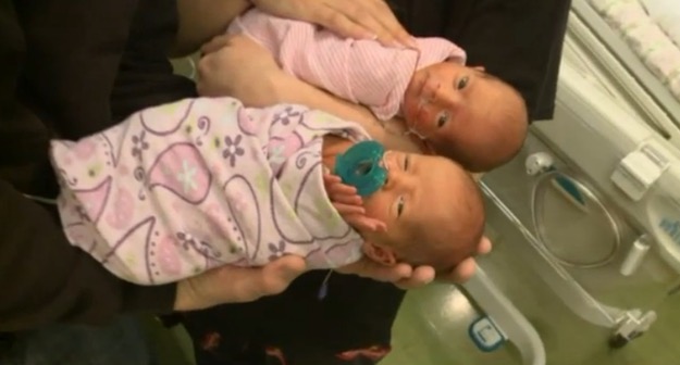 godupdates mom delivers rare twins without knowing she is pregnant 2