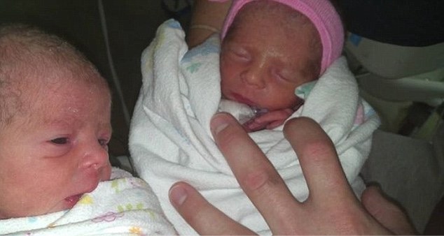 godupdates mom delivers rare twins without knowing she is pregnant 4