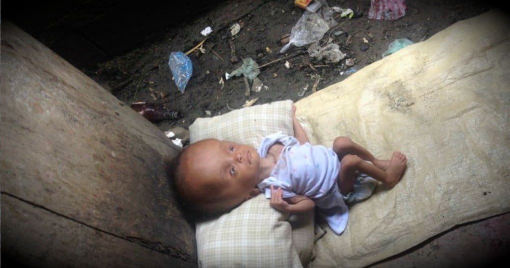 godupdates young woman adopts this unwanted baby from haiti doctors said would die fb