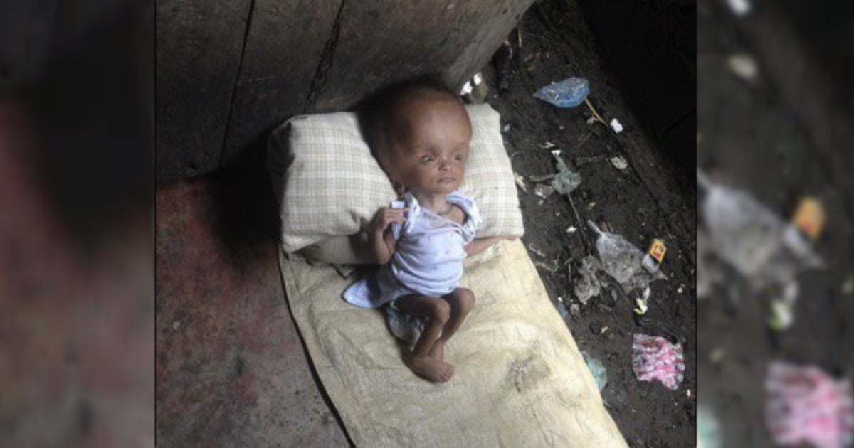 godupdates young woman adopts unwanted baby from haiti doctors said would die 5