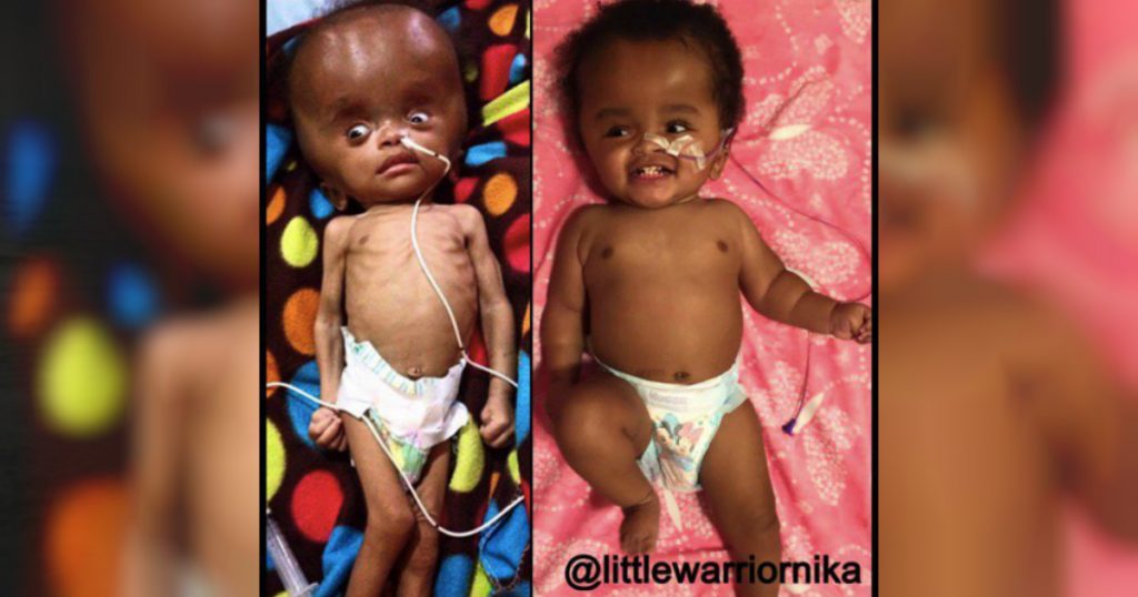 godupdates young woman adopts unwanted baby from haiti doctors said would die 8