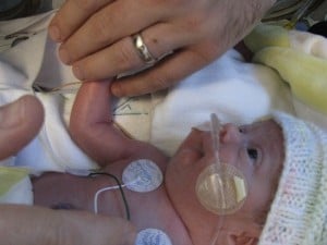 godupdates miracle baby born with no kidneys 4