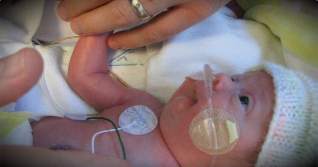 godupdates miracle baby born with no kidneys fb