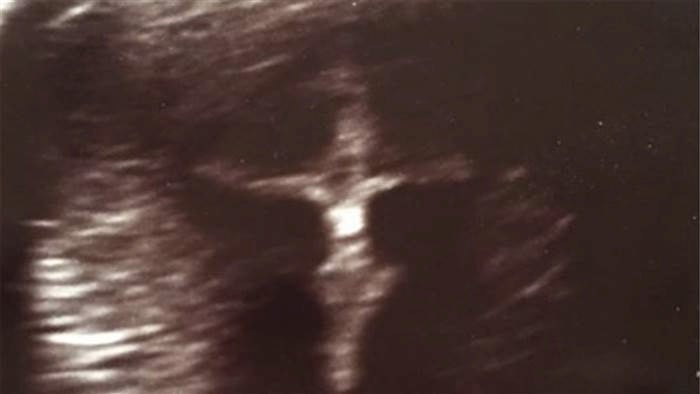 godupdates ultrasound photo of jesus on the cross 3