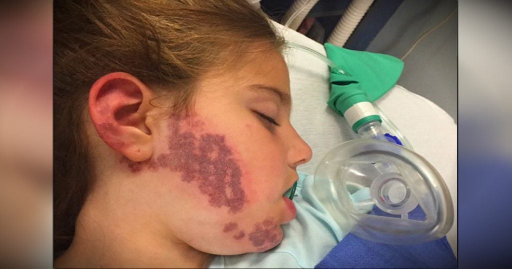 godupdates 7-year-old beauty queen with birthmark esabella fb