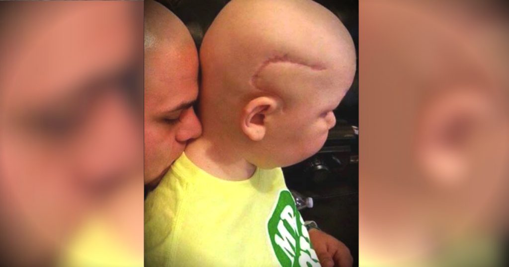 godupdates dad gets tattoo to match son's cancer surgery scar fb