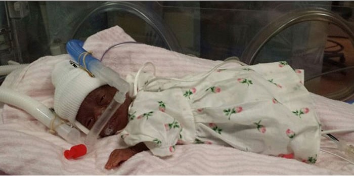godupdates smallest baby born 14 weeks early 10 ounces goes home 1