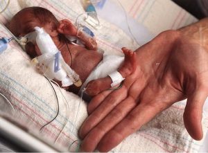 godupdates smallest baby born 14 weeks early 10 ounces goes home 2