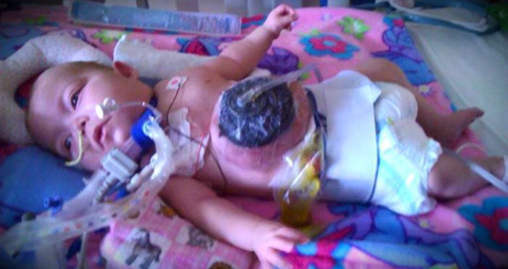 godupdates pediatric nurse adopted abandoned baby girl with birth defect fb