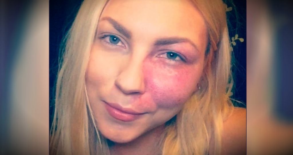 godupdates actress with facial birthmark paige billiot fb