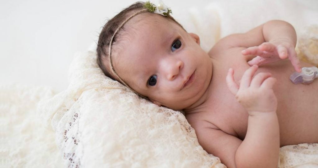 godupdates birth mom kept baby with birth defect when adoption falls through 2