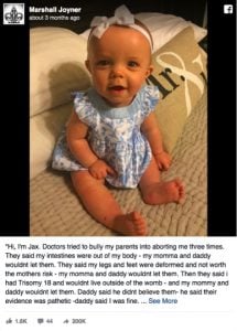 godupdates doctors suggested abortion 3 times baby born perfect 2