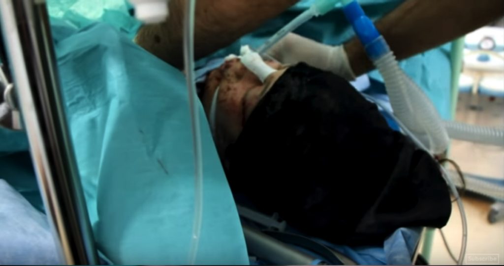 godupdates lifeless baby miraculously brought back to life after syrian airstrike 2