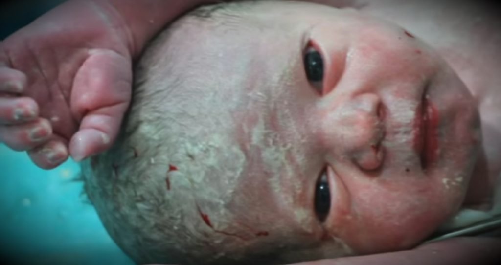 godupdates lifeless baby miraculously brought back to life after syrian airstrike fb