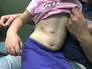 godupdates mountain lion attack 4-year-old girl 2