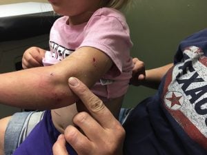 godupdates mountain lion attack 4-year-old girl 3