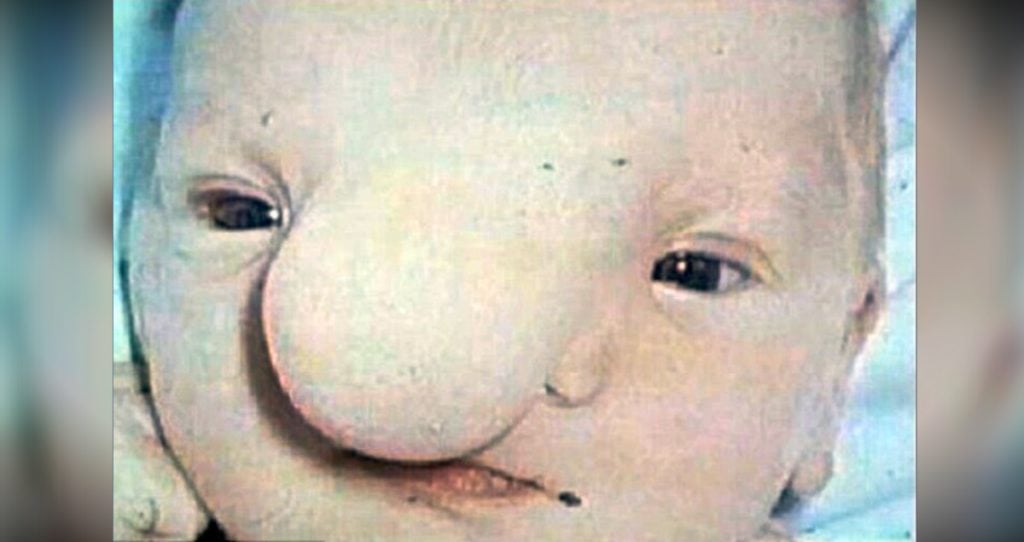 godupdates deformed baby rejected by mother as ugly robert hoge fb