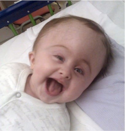 godupdates miracle baby lydia born with adult-sized head 2