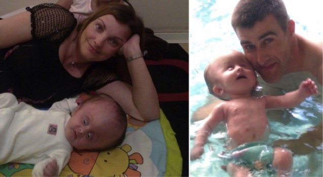 godupdates miracle baby lydia born with adult-sized head 3