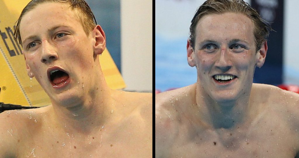 godupdates olympic swimmer mack horton skin cancer mole warning from fan 1