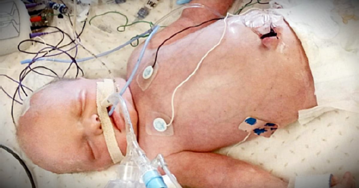 godupdates baby born with no heartbeat saved by mother's milk fb