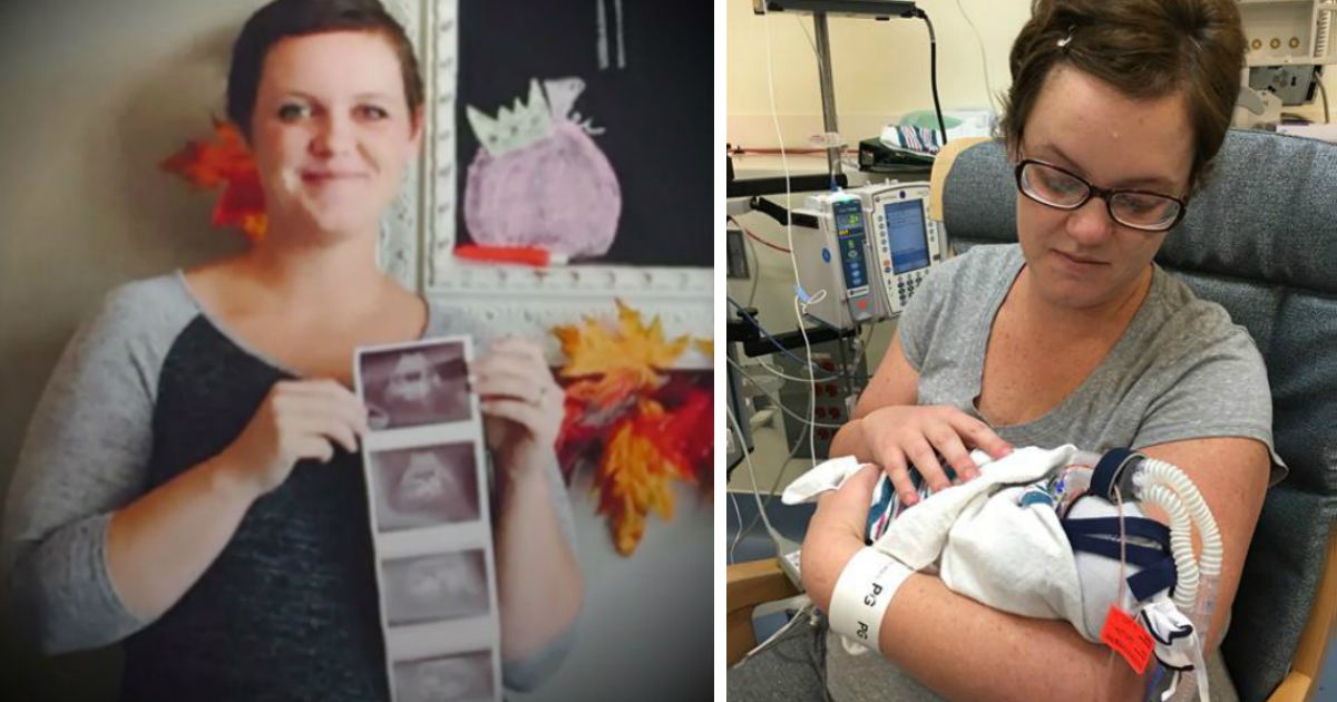 godupdates mom delivered quadruplets while battling cancer FB3