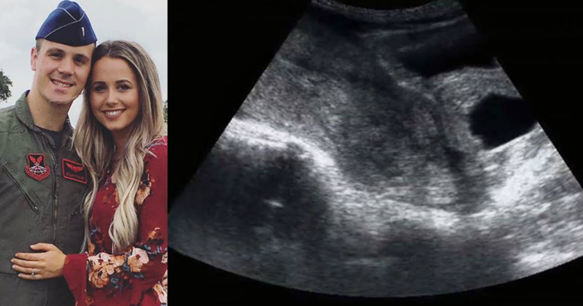godupdates woman's post on how 8-week ultrasound revealed a miscarriage fb