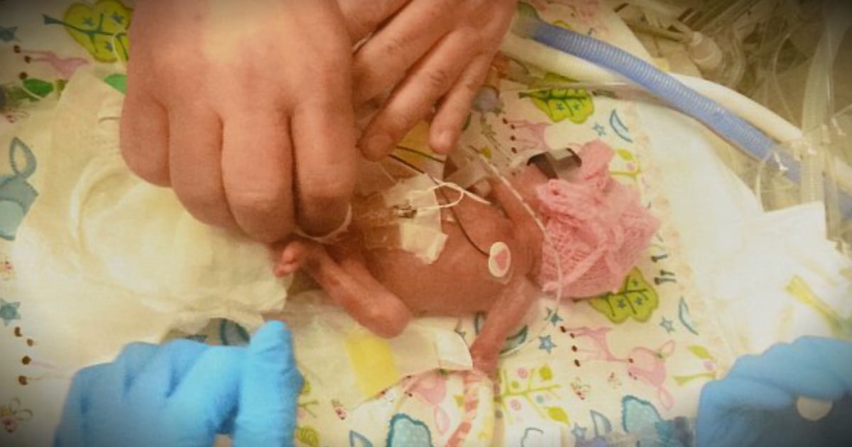 godupdates premature baby with feet the size of pennies is a miracle fb