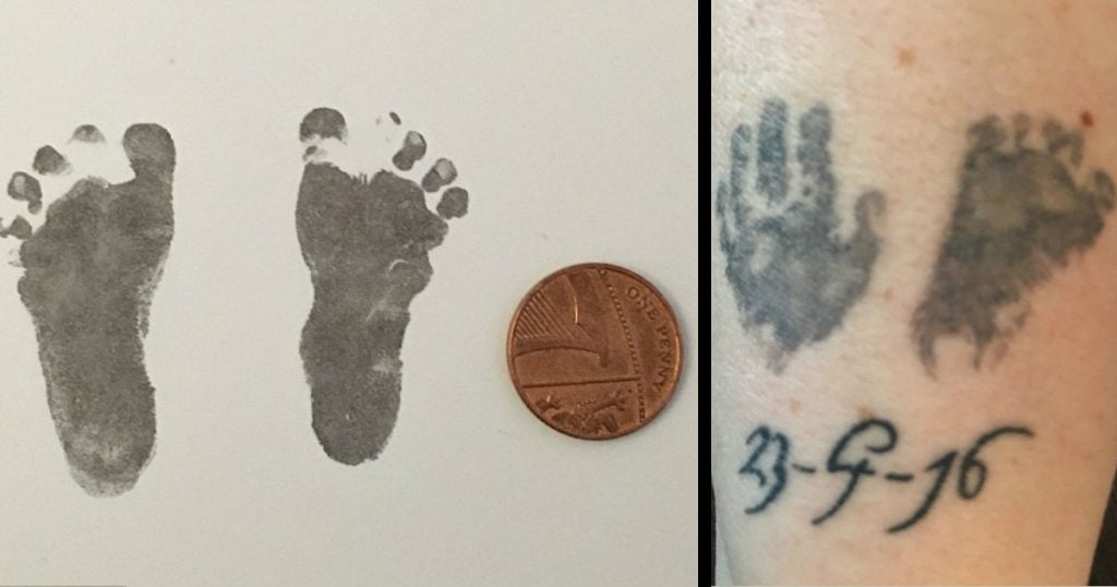 godupdates premature baby with feet the size of pennies is a miracle 1