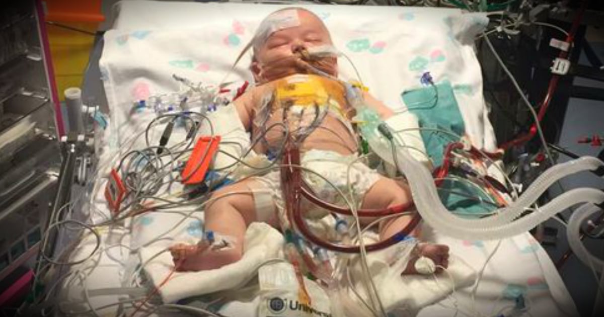 godupdates doctors stopped this miracle baby's heart for 15 hours fb
