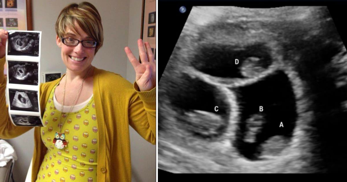 godupdates single mom refuses to abort her quadruplets fb