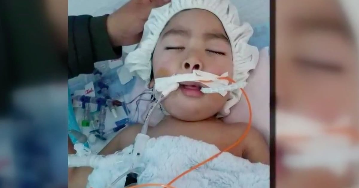 godupdates 2-year-old boy diagnosed vanishing bone disease fb