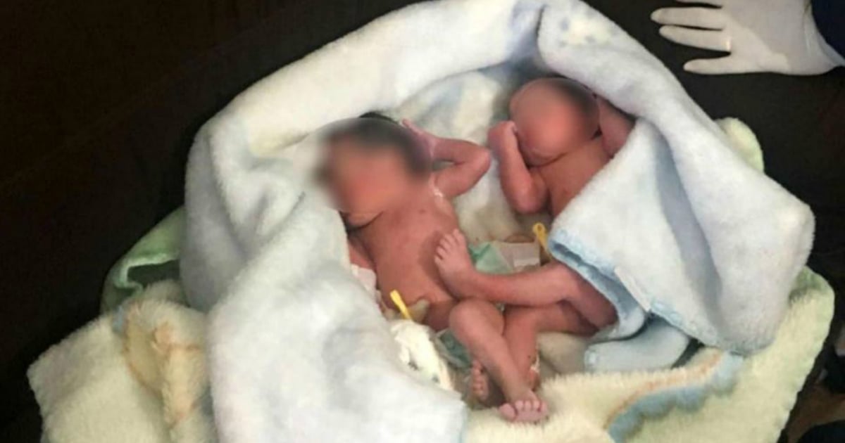 godupdates abandoned newborn twins found in bush in brazil fb