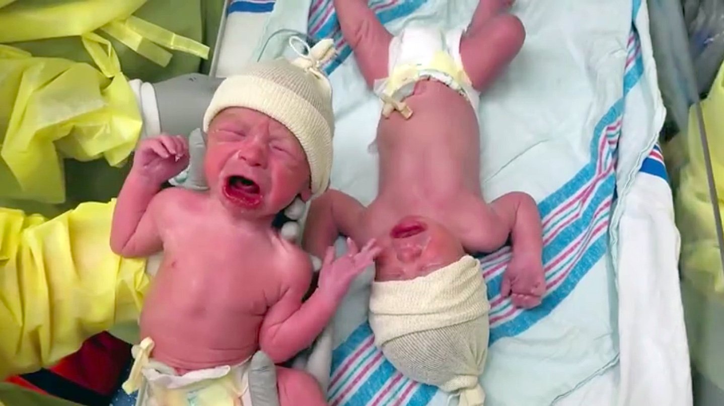 godupdates separated newborn twins stop crying when reunited fb