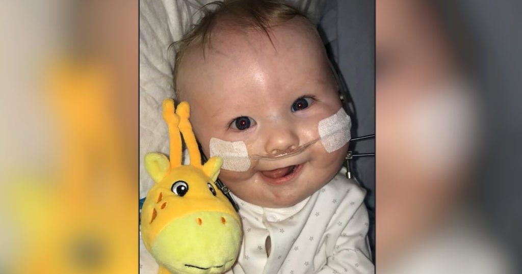 Baby Boy With 'No Jaw' Undergoes Facial Operation That's ...