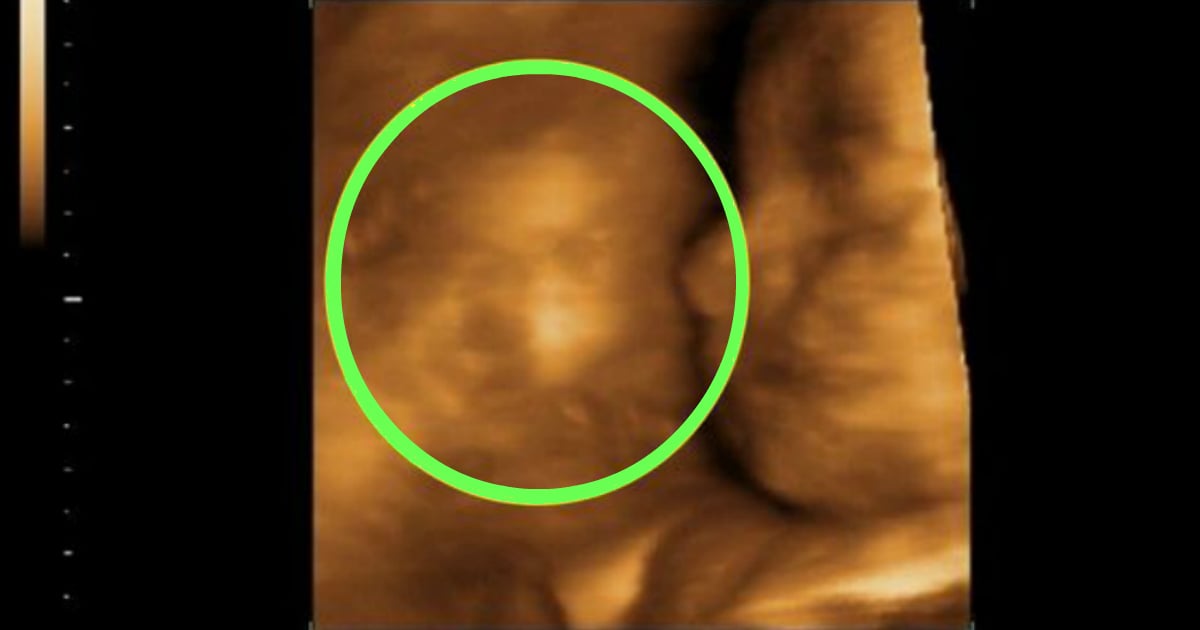 miscarried child's face in ultrasound janes evans fb