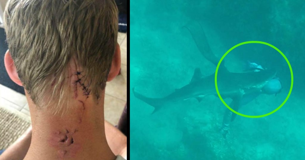 shark attack survivor will krause thanks God fb