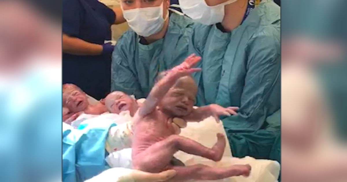 video of triplets c-section birth jessica watts