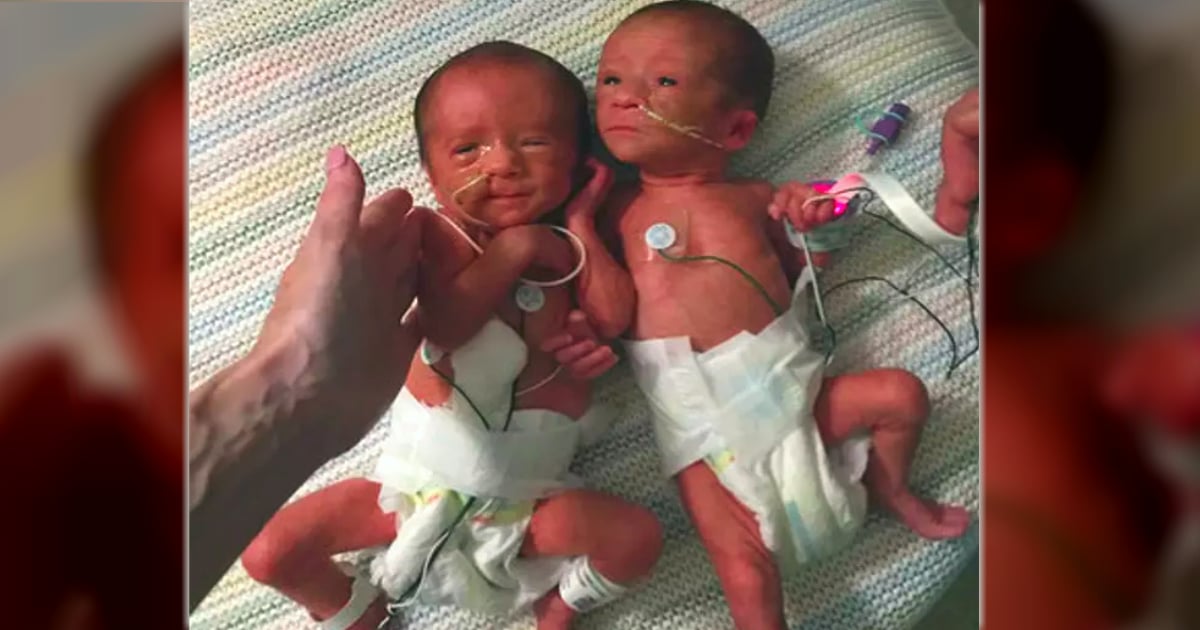 31 weeks baby born twins etta and elizabeth