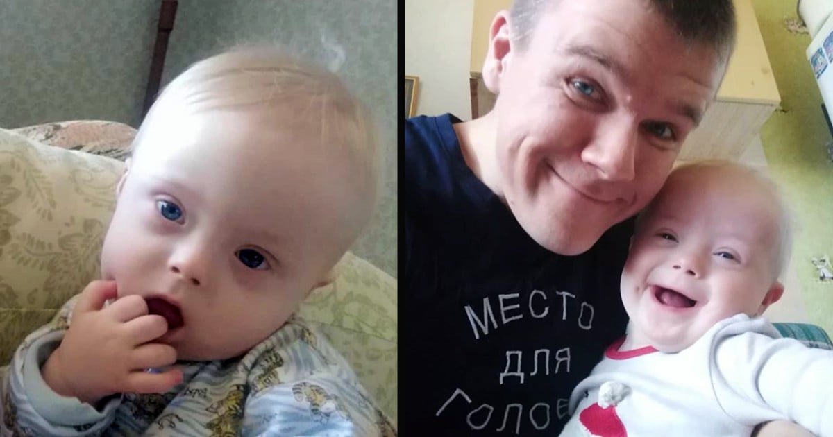 baby with down syndrome Evgeny Anisimov