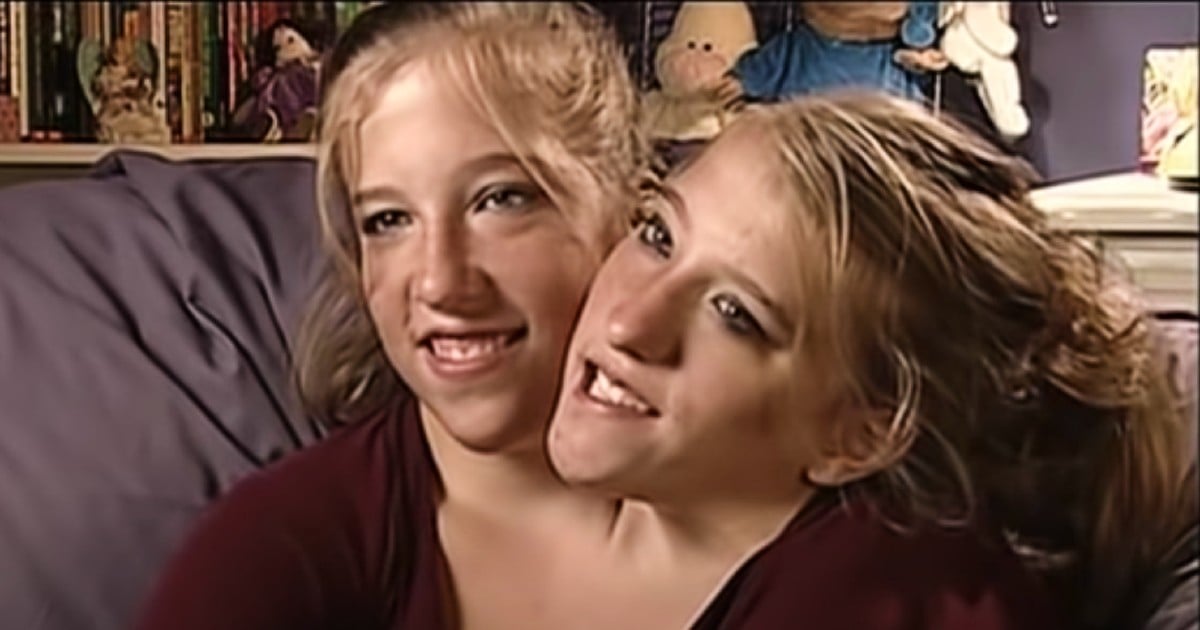 Conjoined Twins Abby and Brittany Now | 2 Miracles Sharing 1 Body