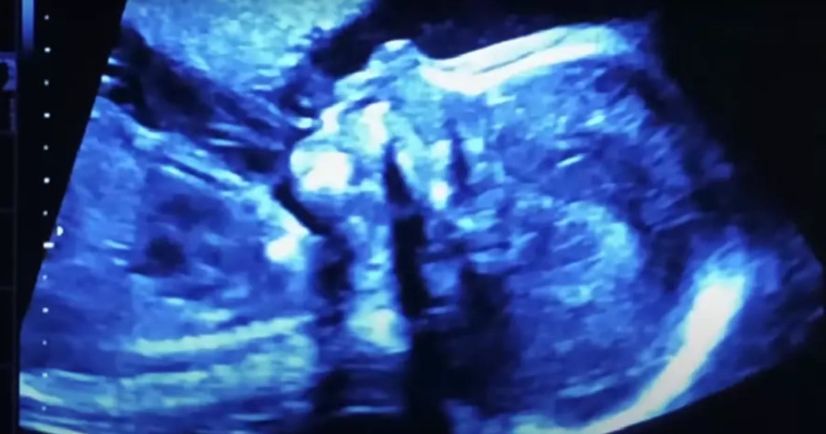 unborn babies in womb ad rejected