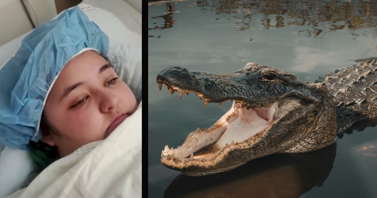 12 foot crocodile teen survives