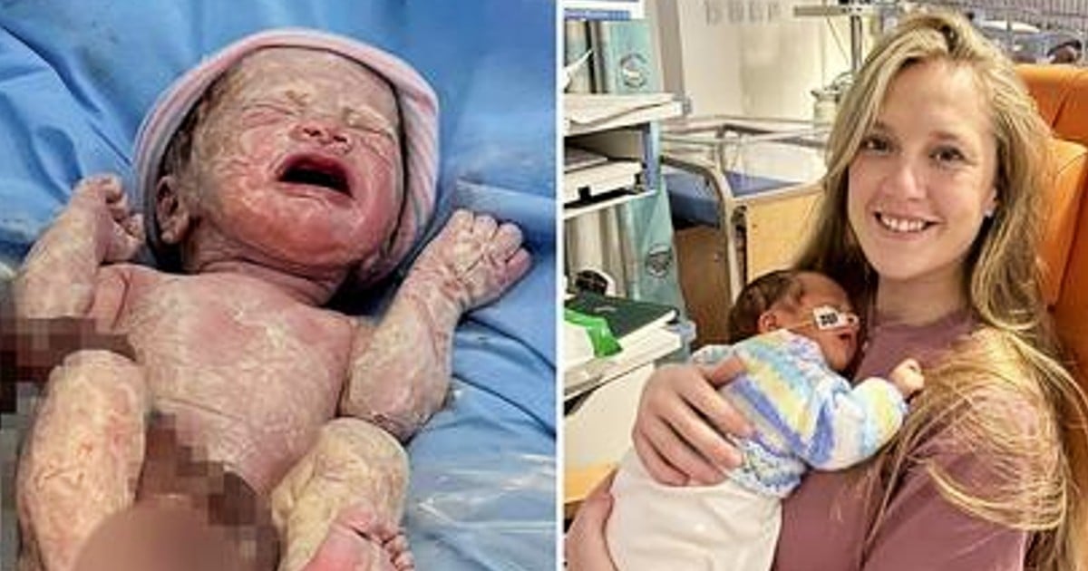 baby born with organs outside of body